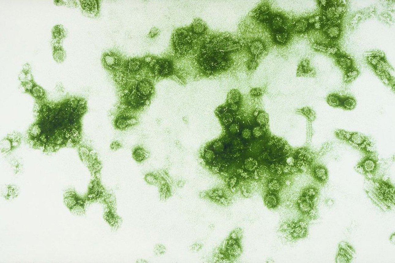 Бактерии против антибиотиков: гонка вооружений, которую мы проигрываем